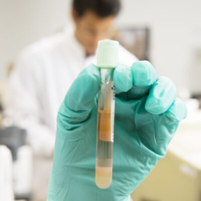 Buy Human Chorionic Gonadotropin online